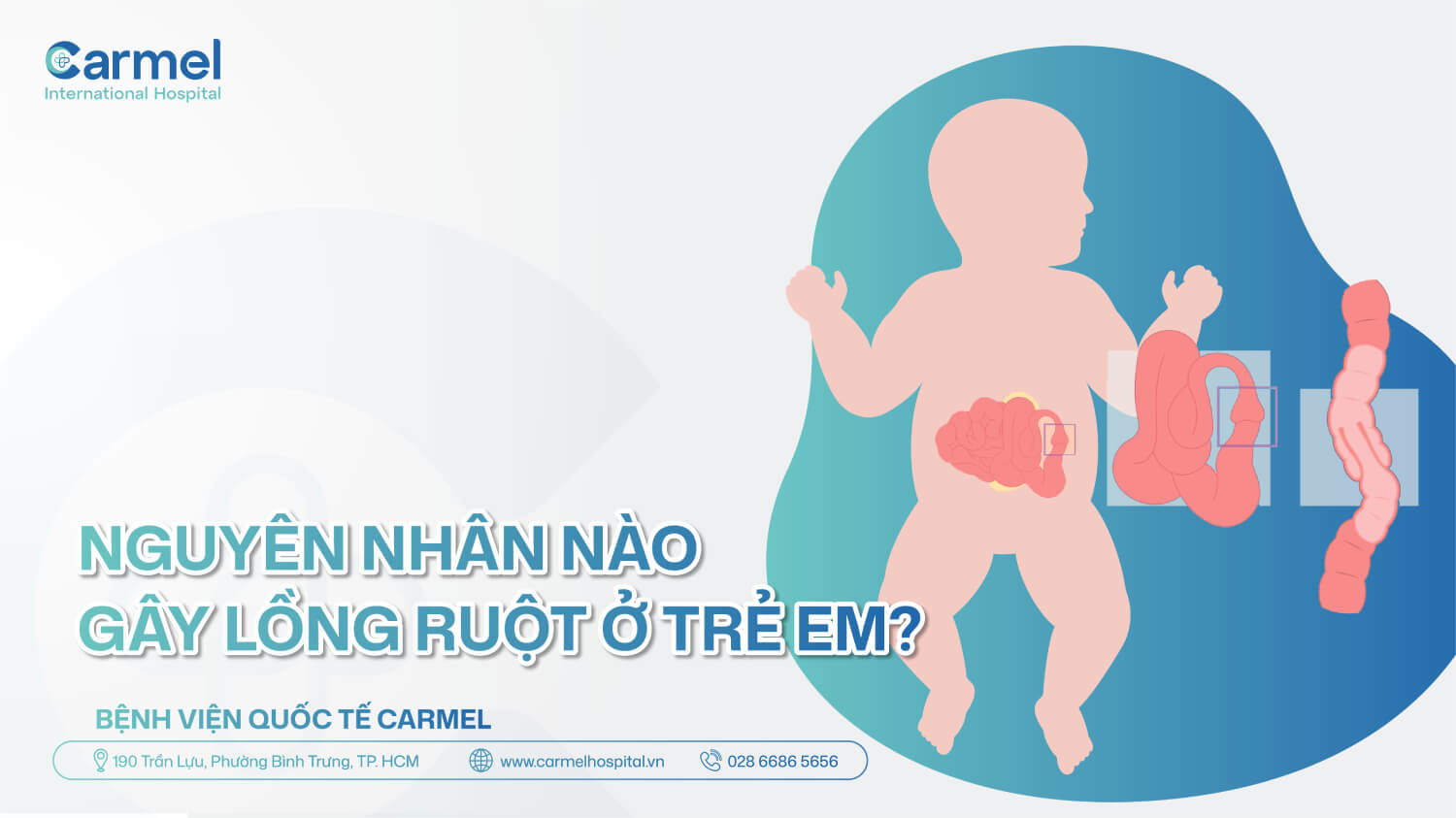 3 dấu hiệu điển hình của lồng ruột ở trẻ em ba mẹ cần biết
