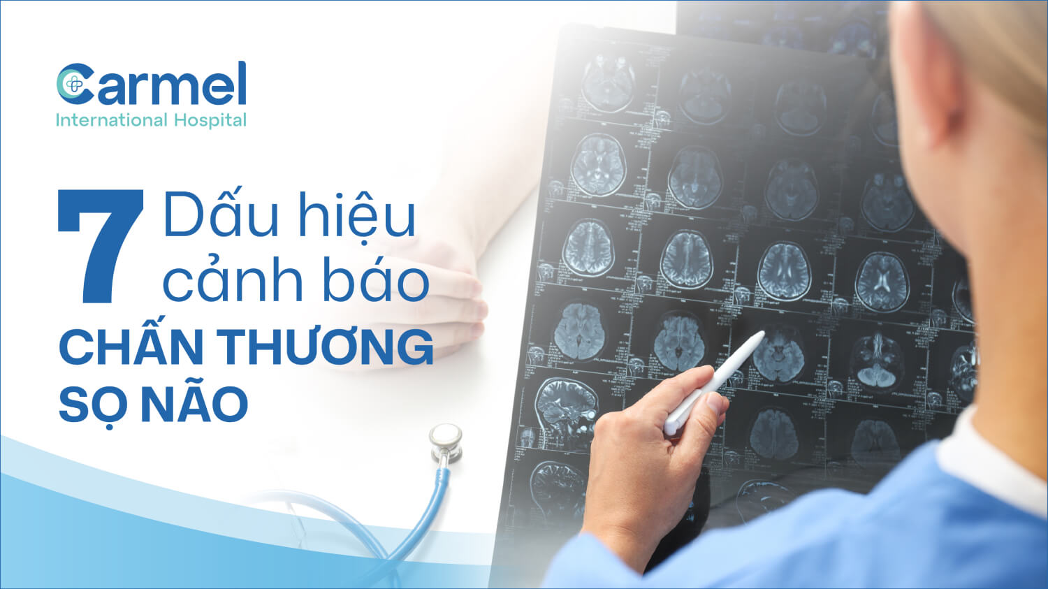 Dấu hiệu chấn thương sọ não: 7 cảnh báo nguy hiểm cần đi cấp cứu ngay