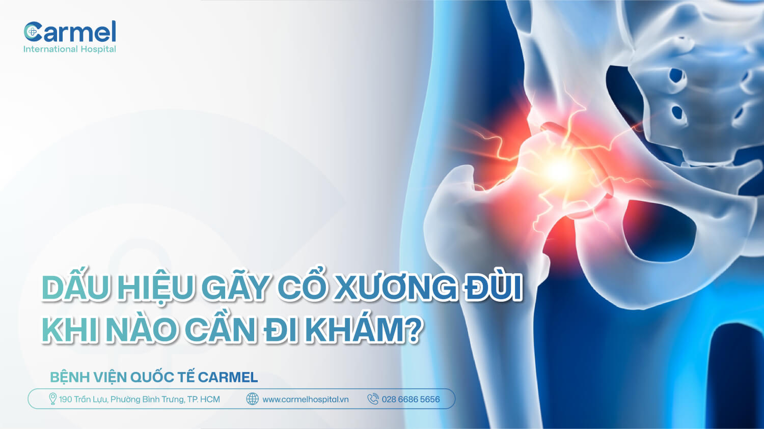 Dấu hiệu gãy cổ xương đùi: Khi nào cần đi khám?