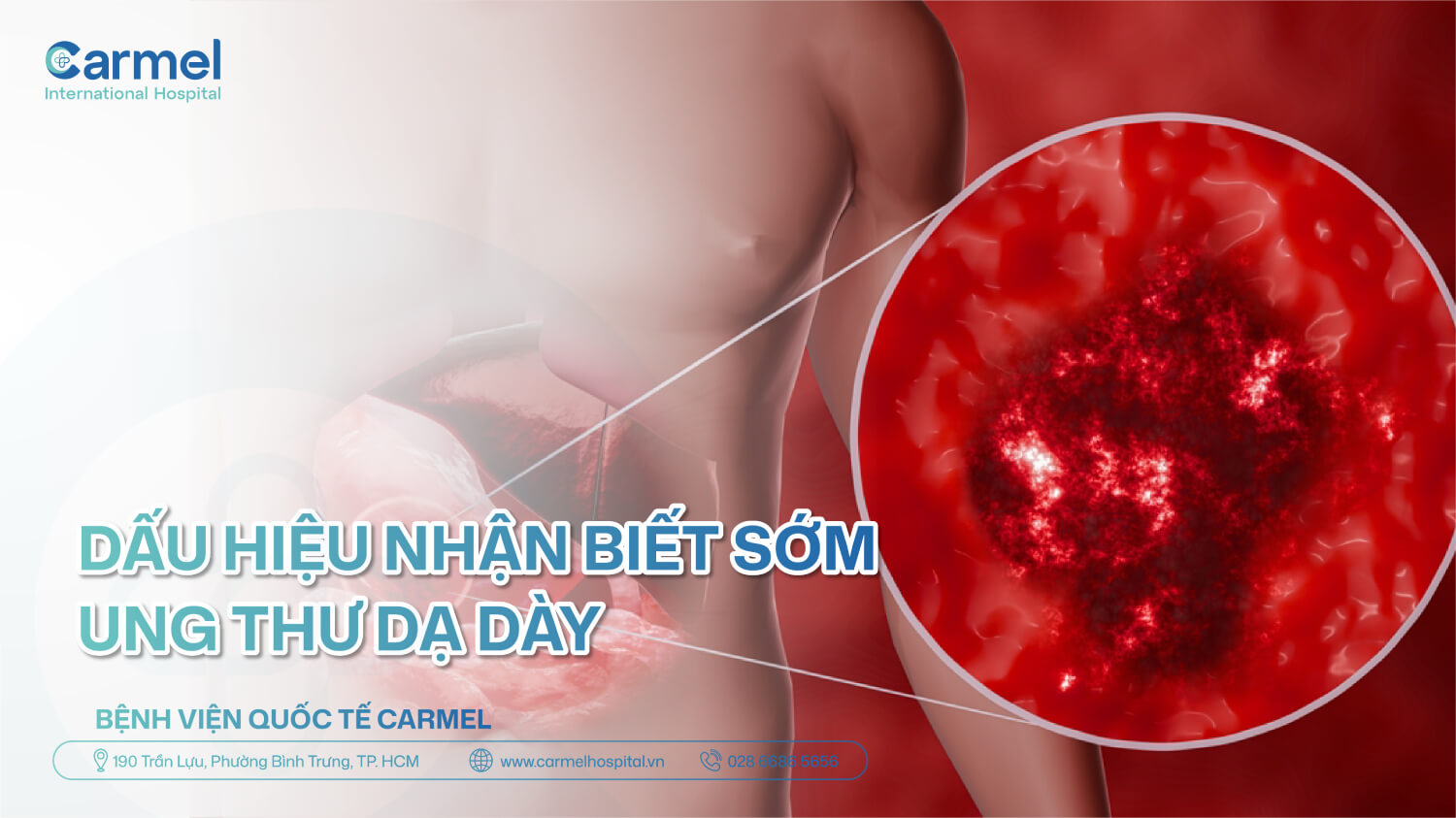Dấu hiệu ung thư dạ dày giai đoạn sớm dễ bị bỏ qua