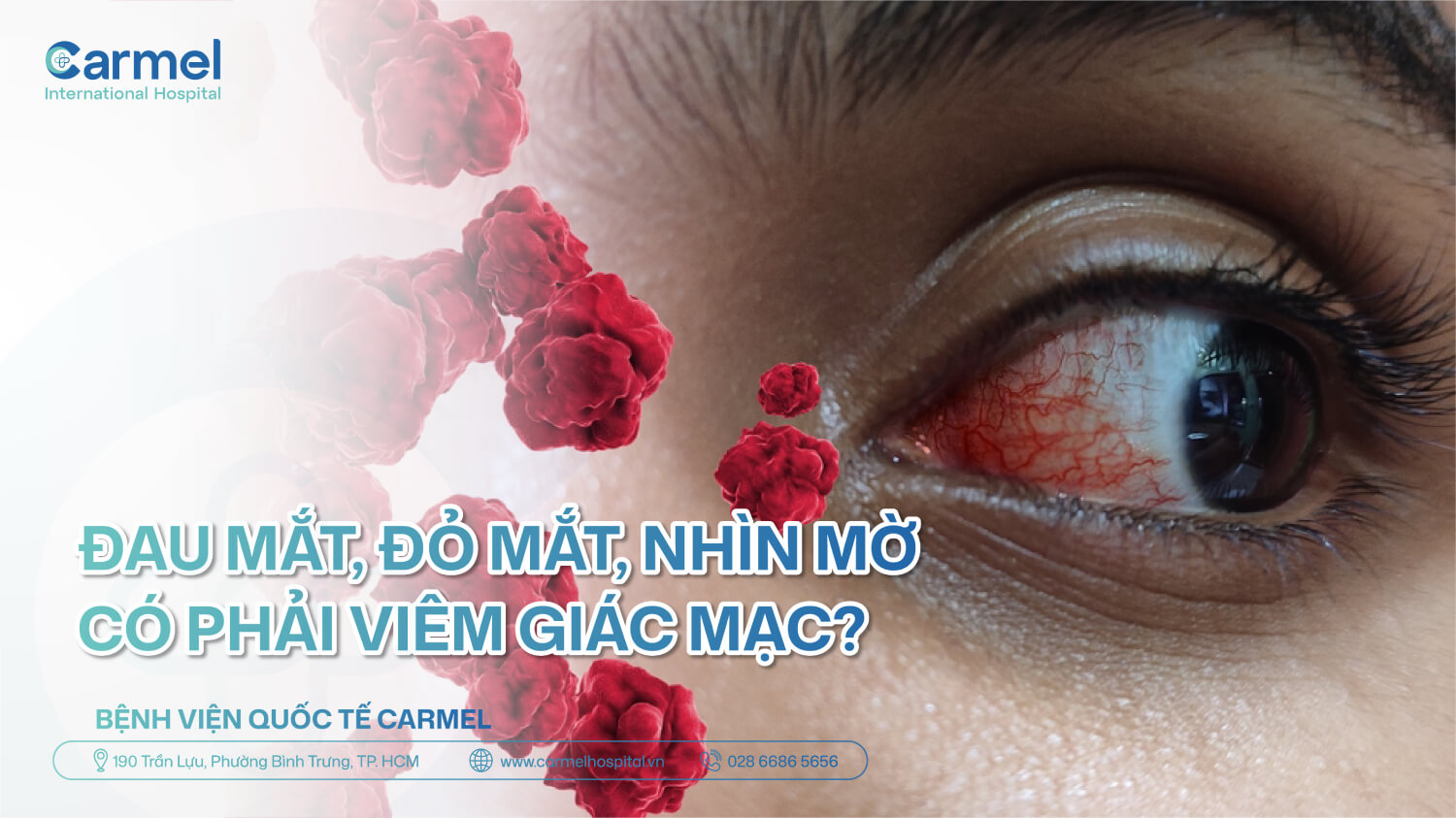 Đau mắt, đỏ mắt, nhìn mờ: Có phải viêm giác mạc không? Cách phân biệt