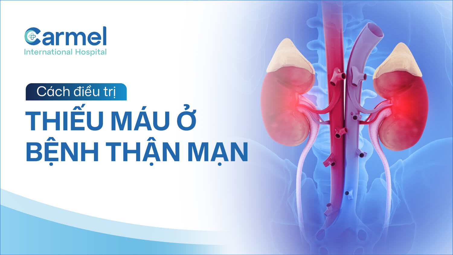Điều trị thiếu máu ở bệnh thận mạn: Khi nào cần bổ sung sắt, dùng thuốc ESA hoặc truyền máu?