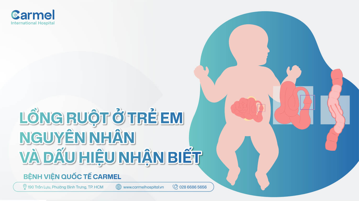 Lồng ruột ở trẻ em là gì? Nguyên nhân, dấu hiệu và cách điều trị