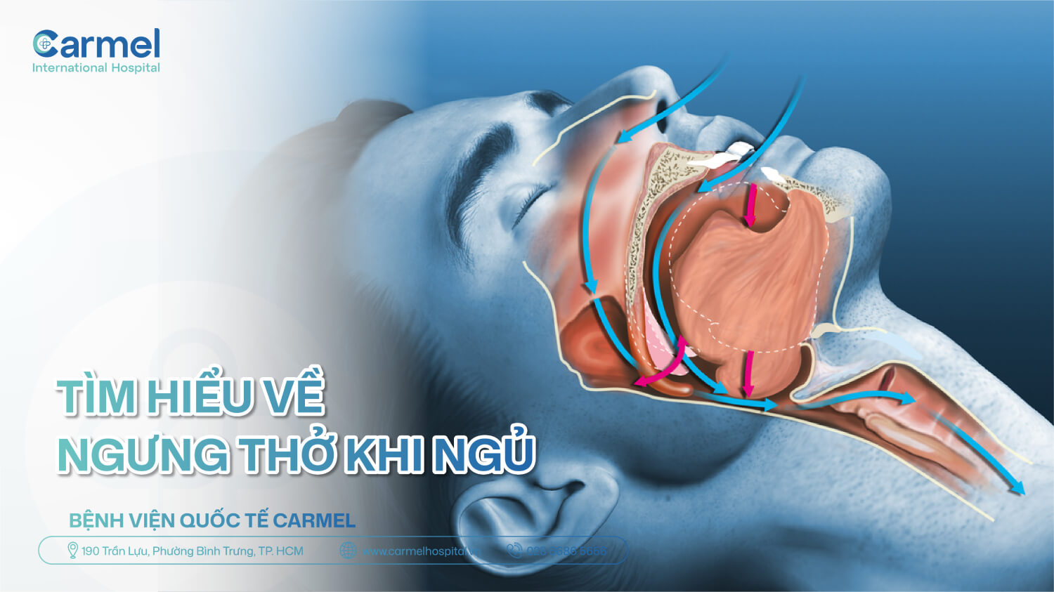 Ngưng thở khi ngủ là gì? Nguyên nhân, dấu hiệu và cách điều trị hiệu quả