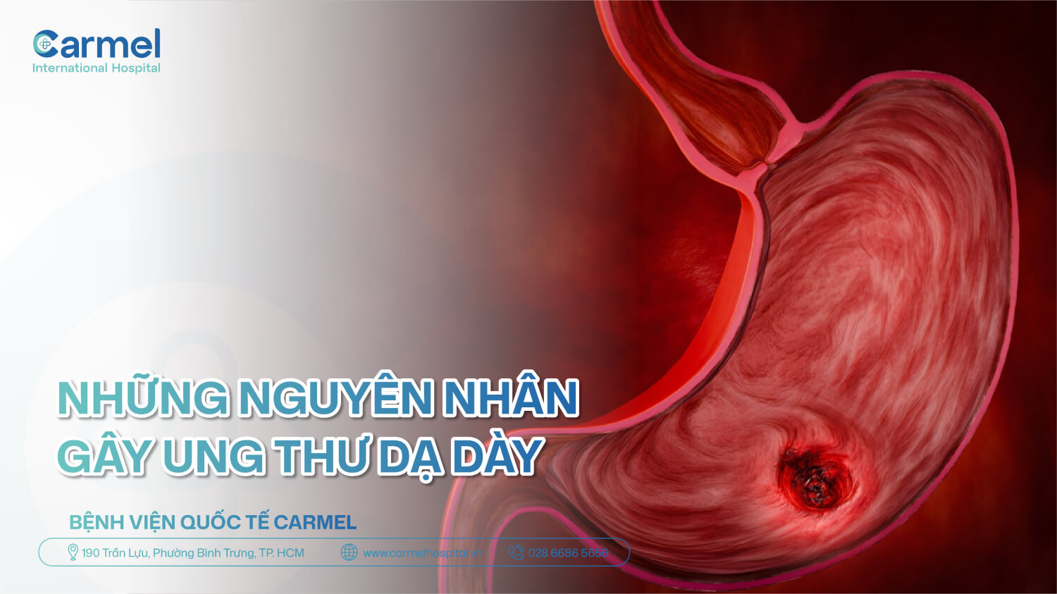 Nguyên nhân ung thư dạ dày: Những yếu tố bạn không nên bỏ qua