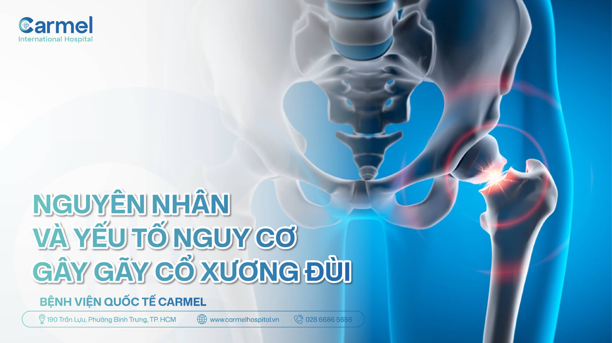 Nguyên nhân và yếu tố nguy cơ gãy cổ xương đùi