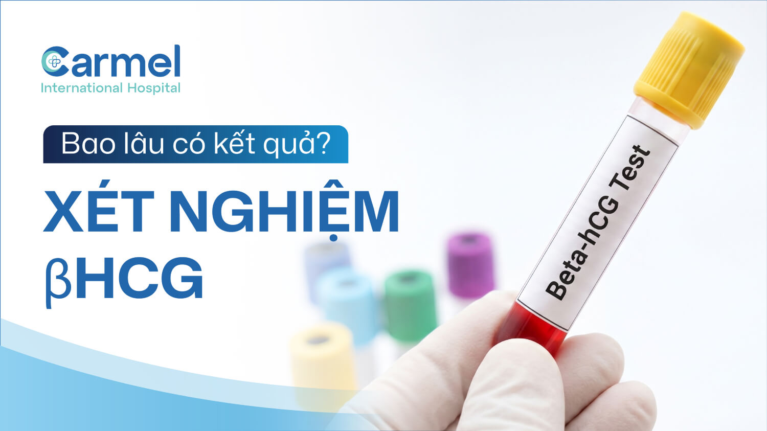 Xét nghiệm βHCG bao lâu có kết quả? Khi nào làm để chính xác nhất?